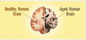 衰老的大脑