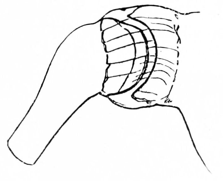 肩关节