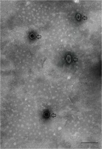 来自蜱虫唾液的类外泌体囊泡透射电子显微图。箭头表示由蜱虫衍生的EV。比例条：100纳米。