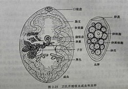并殖吸虫 并殖吸虫